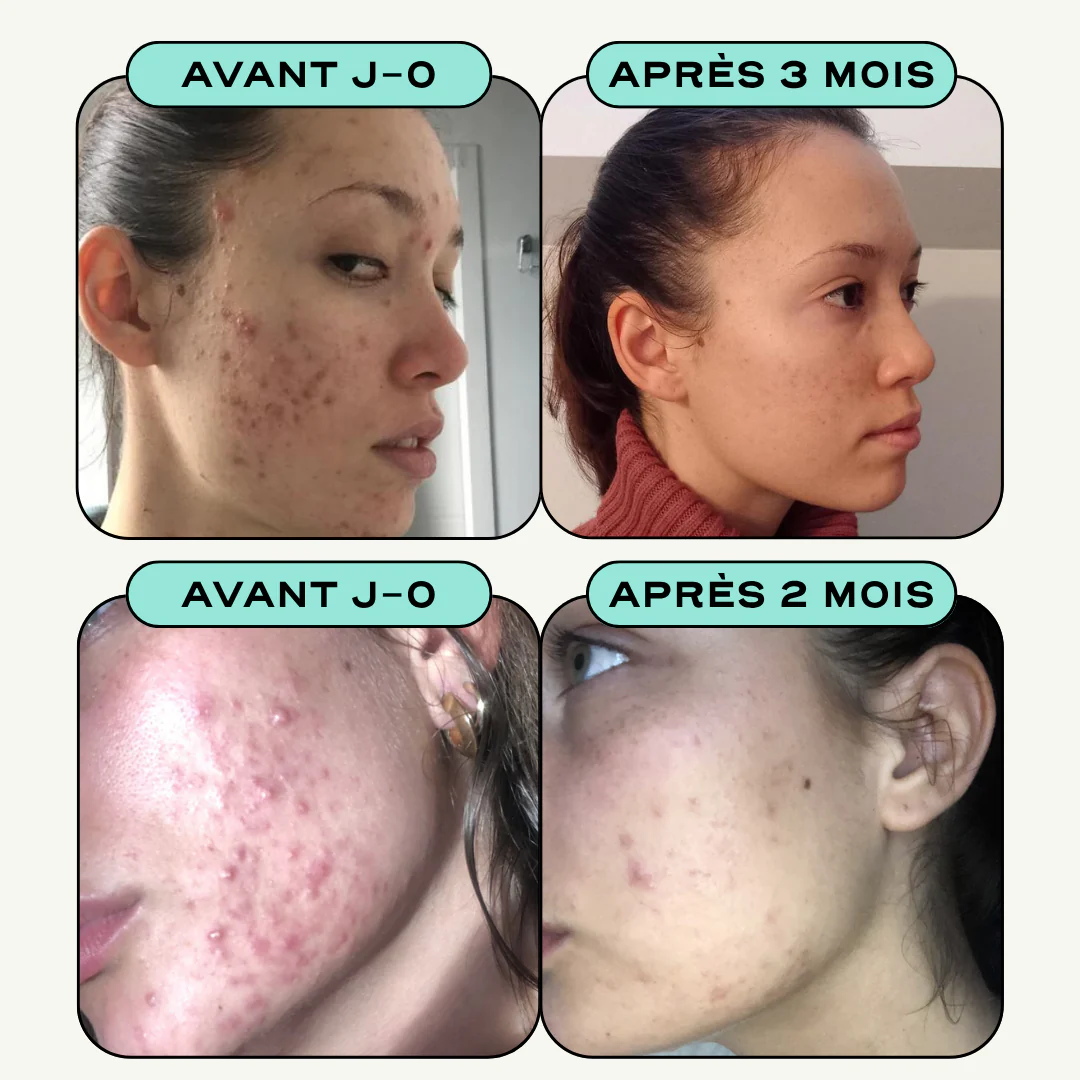 Image du produit 9